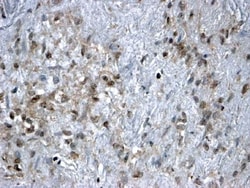 FOXL2 Antibody, Novus Biologicals:Antibodies:Primary Antibodies